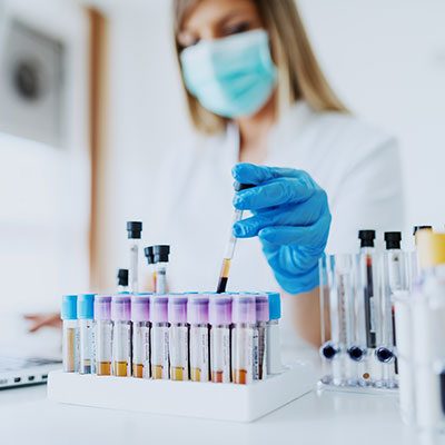 Lab-Testing-Blood-ChemistrySQ.jpg
